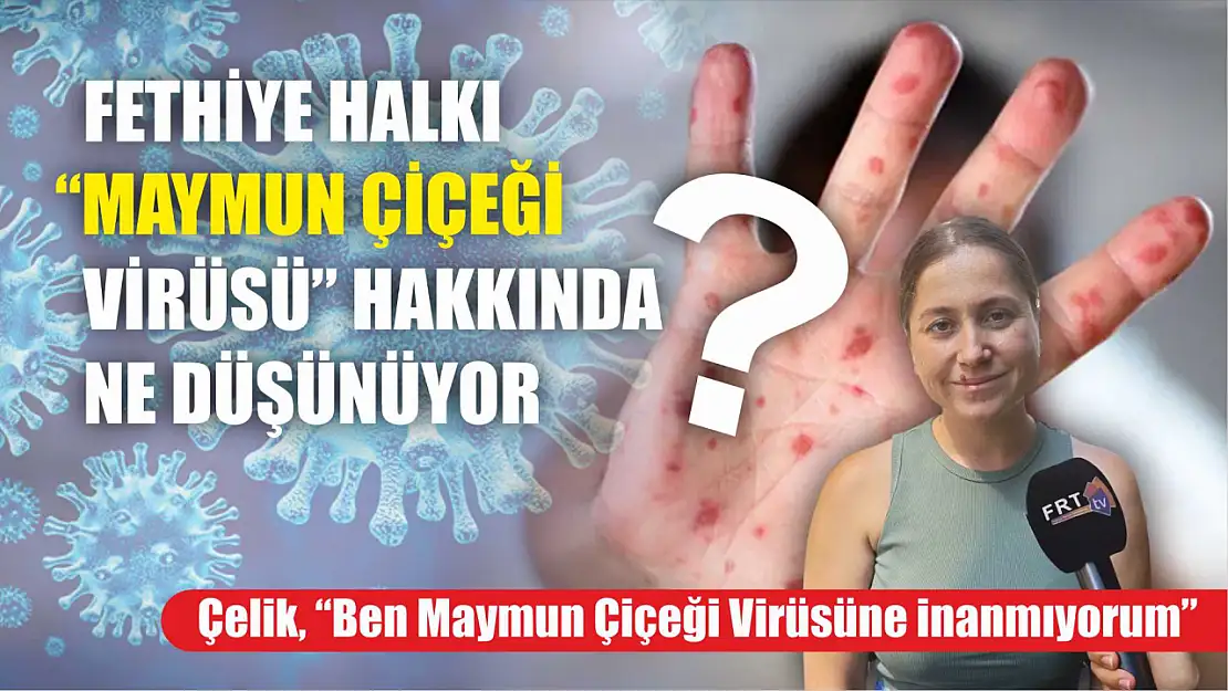 Fethiye halkı 'Maymun Çiçeği Virüsü' hakkında ne düşünüyor?