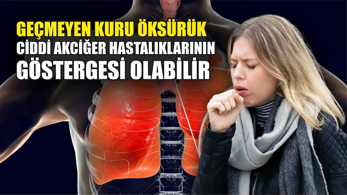 Geçmeyen kuru öksürük, ciddi akciğer hastalıklarının göstergesi olabilir