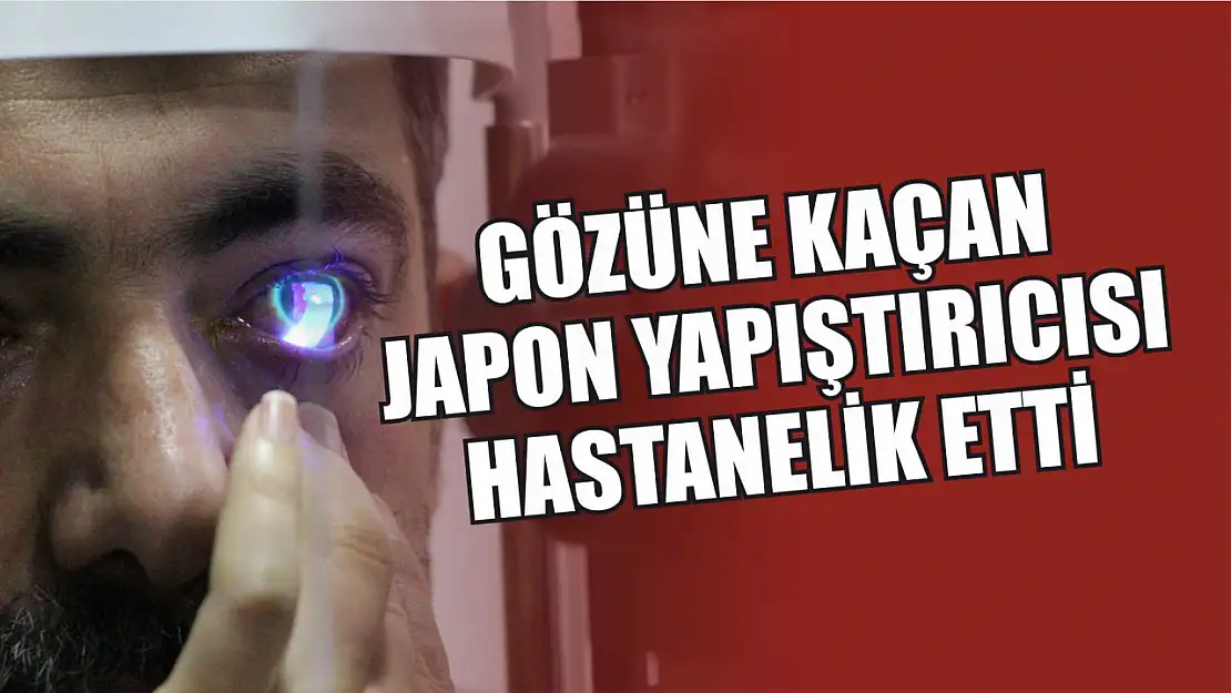 Gözüne kaçan Japon yapıştırıcısı hastanelik etti