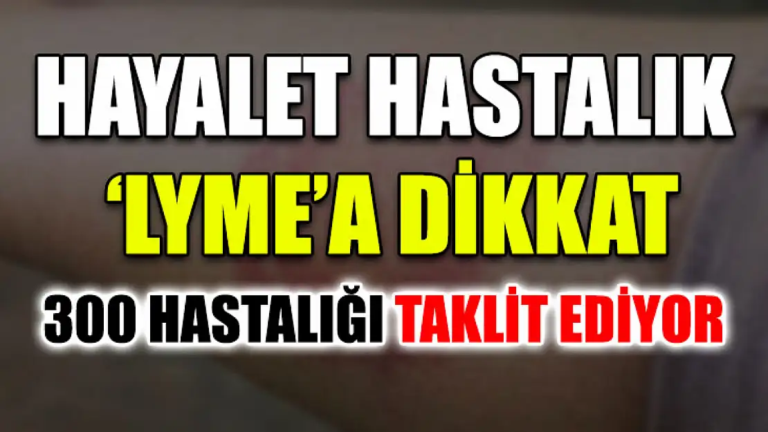 Hayalet hastalık 'lyme'a dikkat: 300 hastalığı taklit ediyor