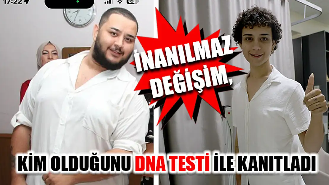 İnanılmaz Değişim, Kim Olduğunu DNA Testi İle Kanıtladı