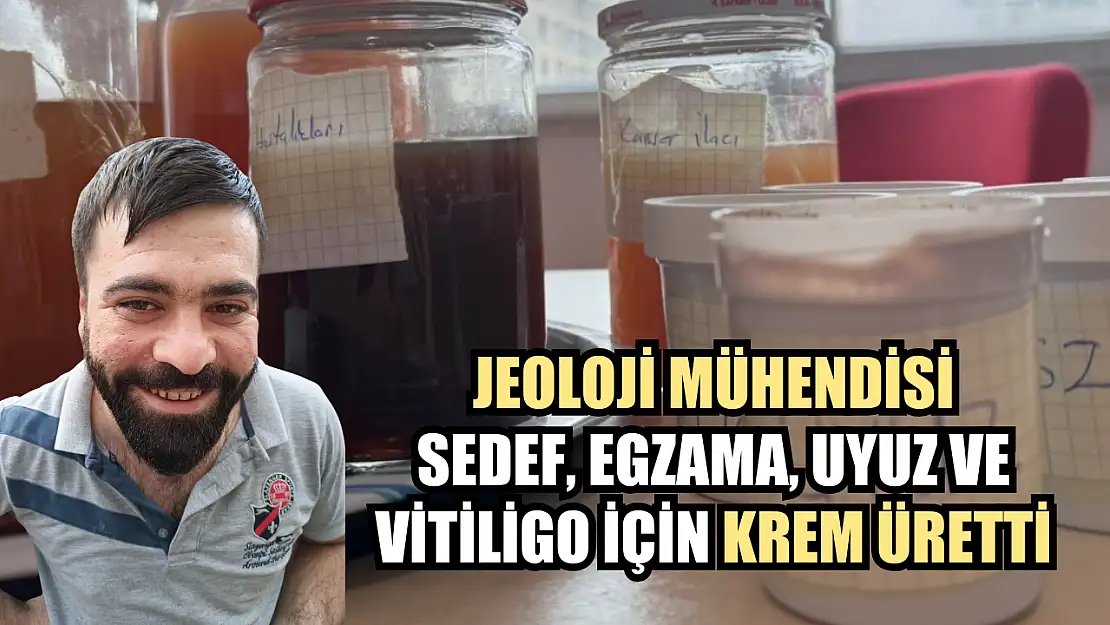 Jeoloji mühendisi sedef, egzama, uyuz ve vitiligo için krem üretti