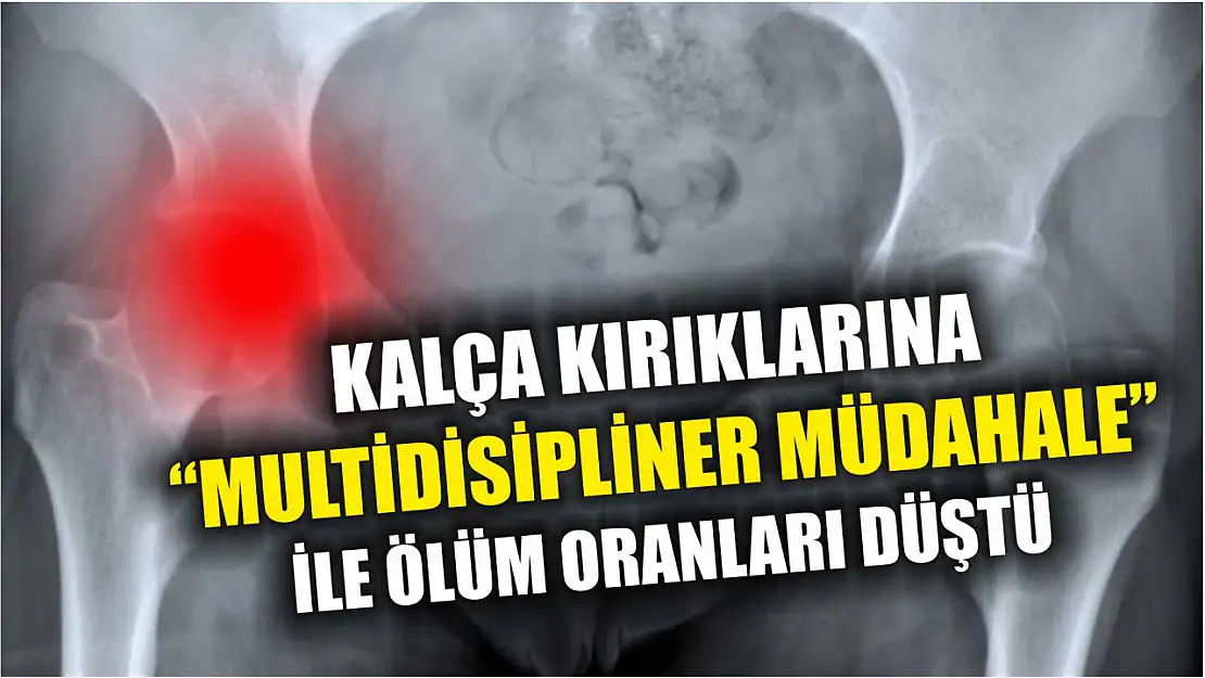 Kalça kırıklarına 'multidisipliner müdahale' ile ölüm oranları düştü