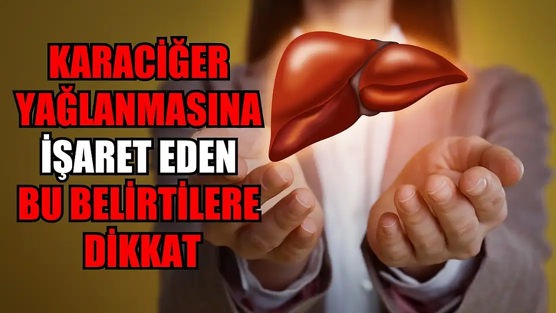 Karaciğer yağlanmasına işaret eden bu belirtilere dikkat