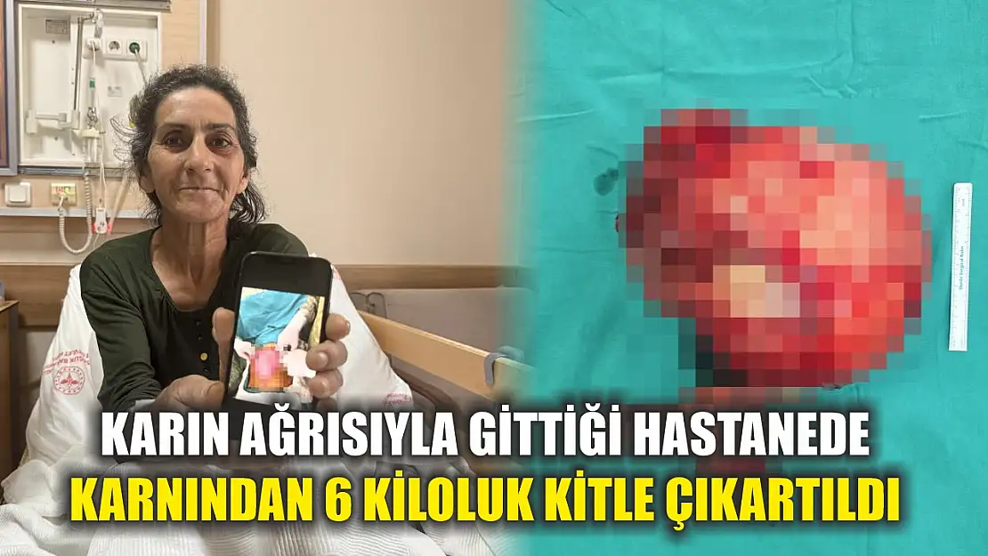 Karın ağrısıyla gittiği hastanede karnından 6 kiloluk kitle çıkartıldı