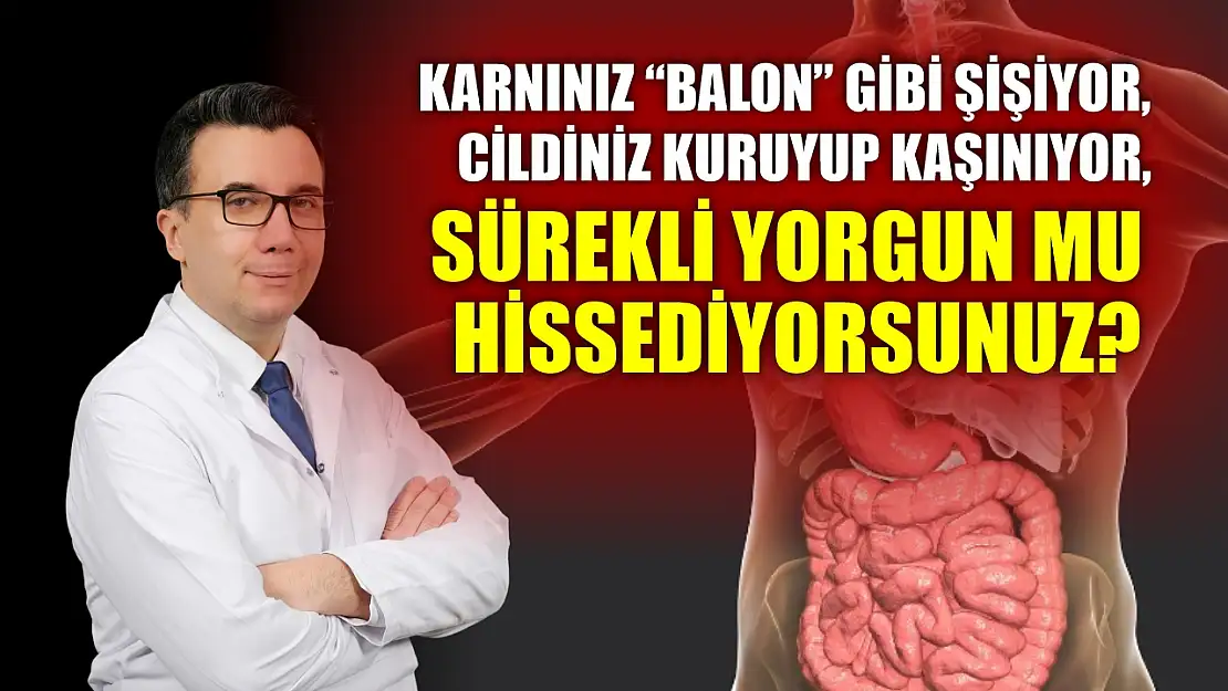 Karnınız 'balon' gibi şişiyor, cildiniz kuruyup kaşınıyor, sürekli yorgun mu hissediyorsunuz?