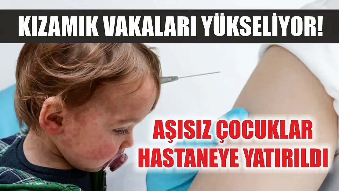 Kızamık vakaları yükseliyor! Aşısız çocuklar hastaneye yatırıldı