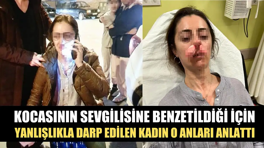 Kocasının sevgilisine benzetildiği için yanlışlıkla darp edilen kadın o anları anlattı