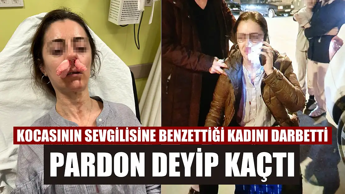 Kocasının sevgilisine benzettiği kadını darbetti, pardon deyip kaçtı