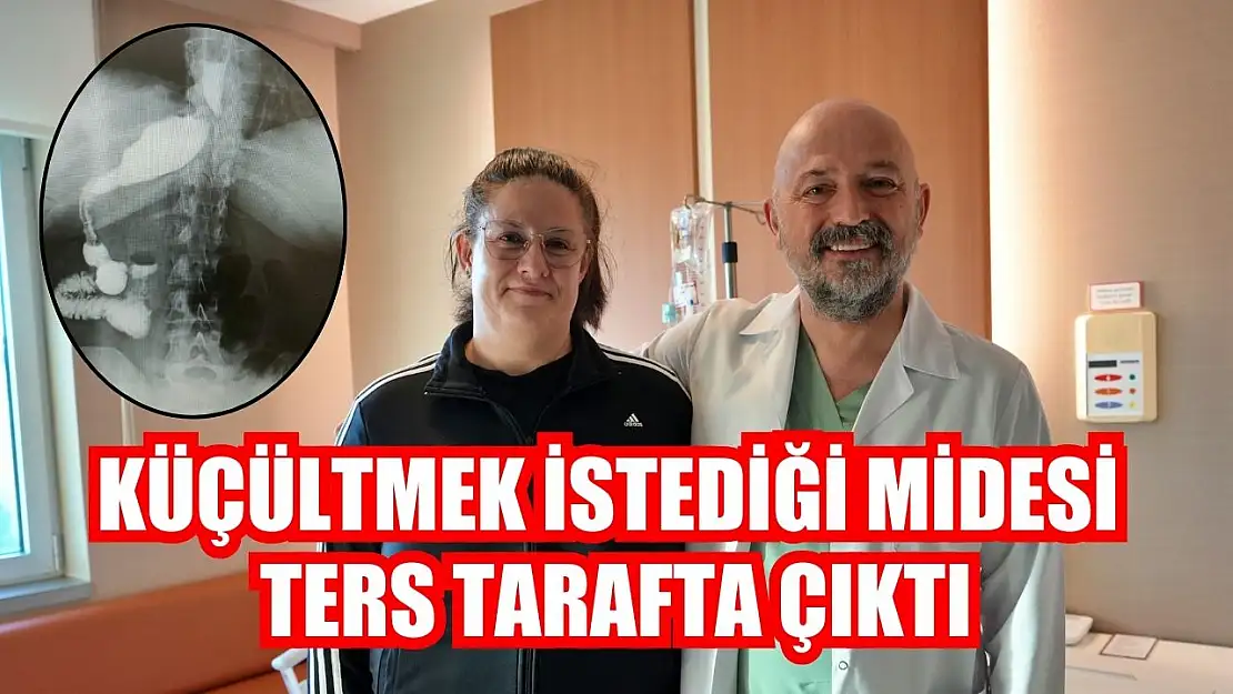 Küçültmek istediği midesi ters tarafta çıktı