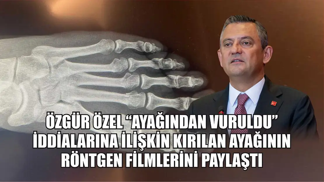 Özgür Özel 'ayağından vuruldu' iddialarına ilişkin kırılan ayağının röntgen filmlerini paylaştı