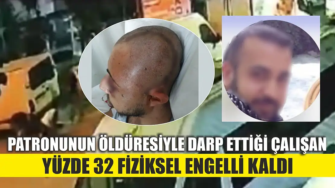 Patronunun öldüresiyle darp ettiği çalışan yüzde 32 fiziksel engelli kaldı