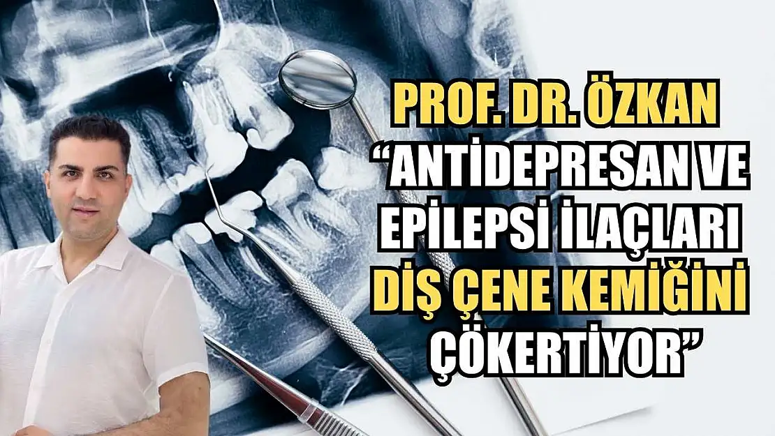 Prof. Dr. Özkan : 'Antidepresan ve epilepsi ilaçları diş çene kemiğini çökertiyor'