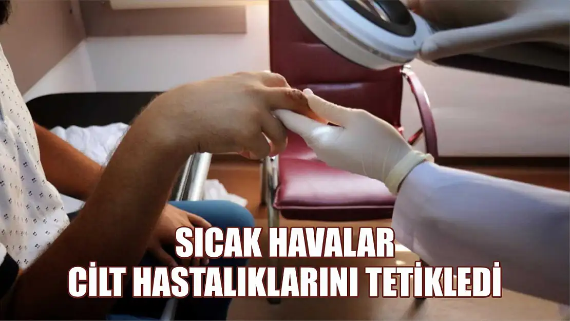 Sıcak havalar cilt hastalıklarını tetikledi