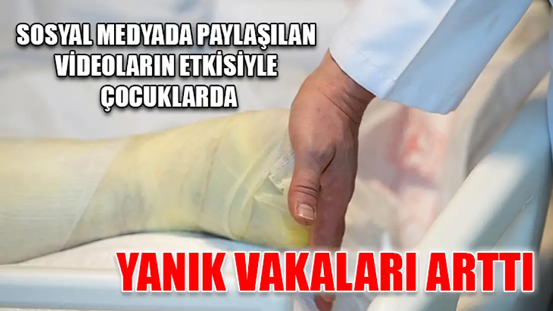 Sosyal medyada paylaşılan videoların etkisiyle çocuklarda yanık vakaları arttı