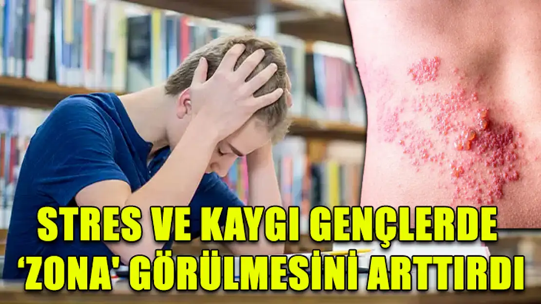 Stres ve kaygı gençlerde 'Zona' görülmesini arttırdı