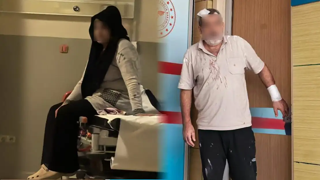 Tartışan çift birbirlerini tencere ve bıçakla yaraladı