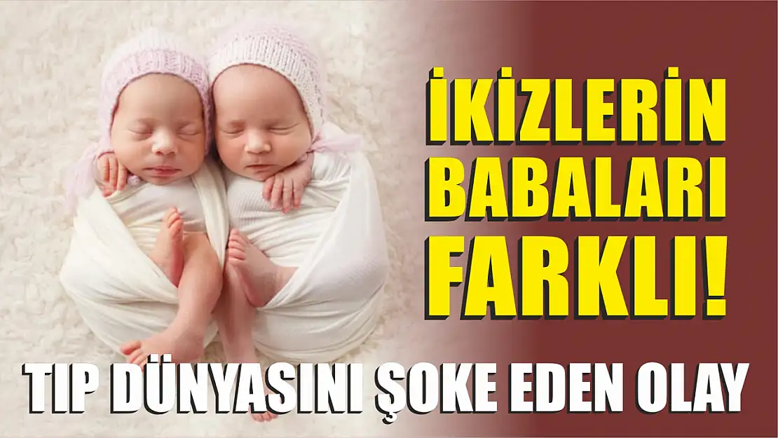 Tıp dünyasını şoke eden olay: İkizlerin babaları farklı çıktı!