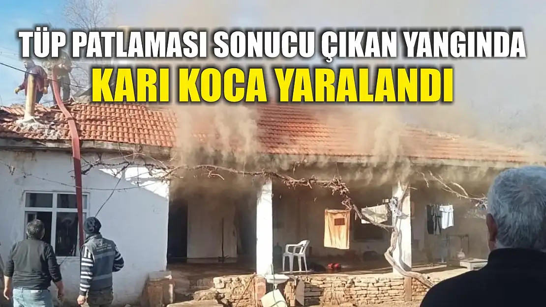 Tüp patlaması sonucu çıkan yangında karı koca yaralandı