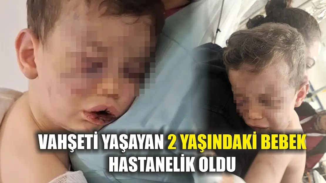 Vahşeti yaşayan 2 yaşındaki bebek hastanelik oldu