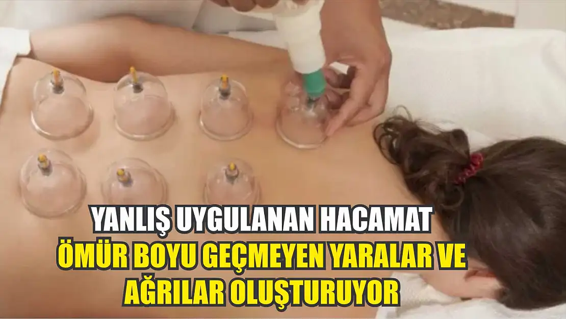 Yanlış uygulanan hacamat ömür boyu geçmeyen yaralar ve ağrılar oluşturuyor