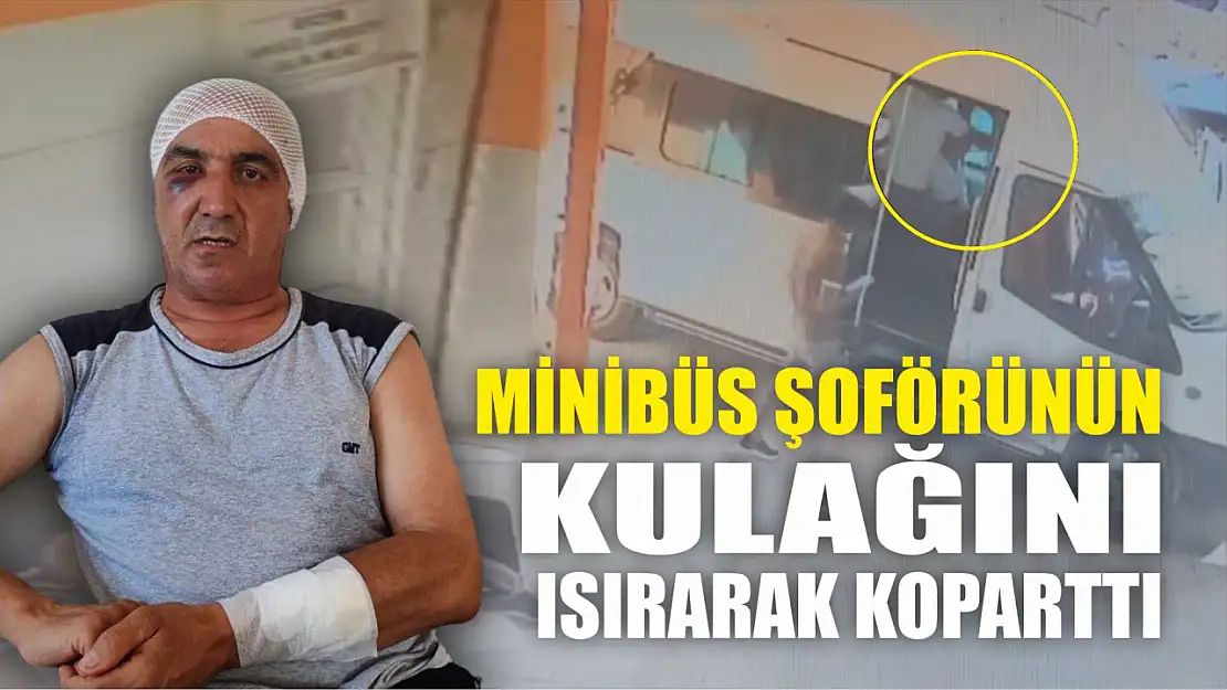 Yolcu, minibüs şoförünün kulağını ısırarak koparttı