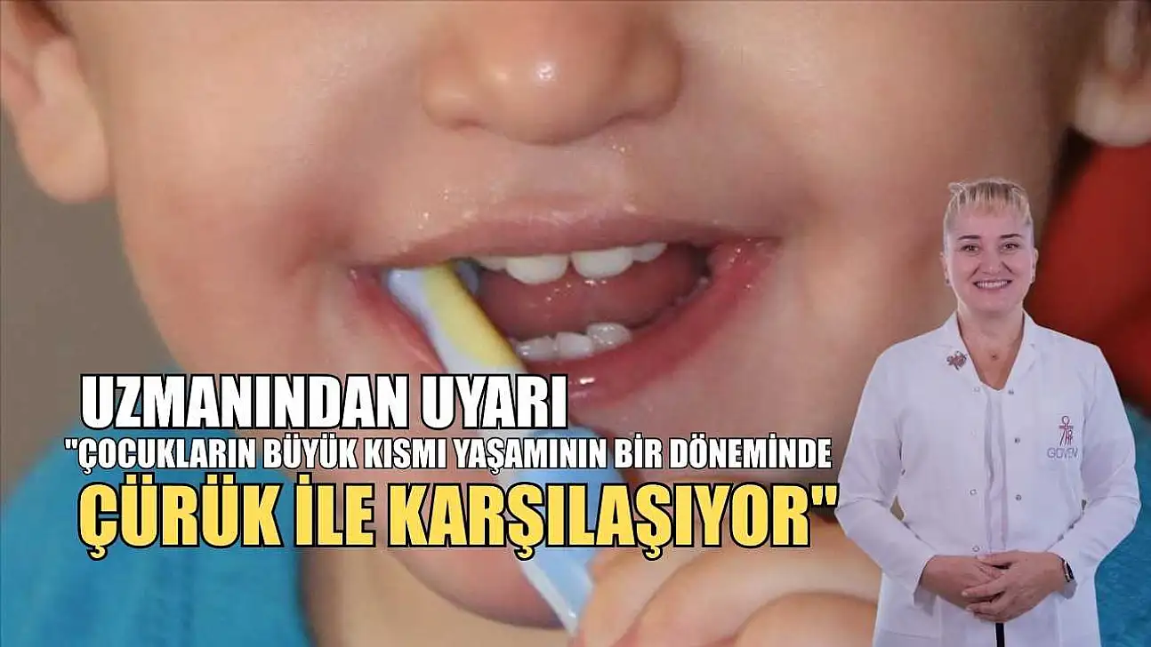 Uzmanından uyarı: 'Çocukların büyük kısmı yaşamının bir döneminde çürük ile karşılaşıyor'