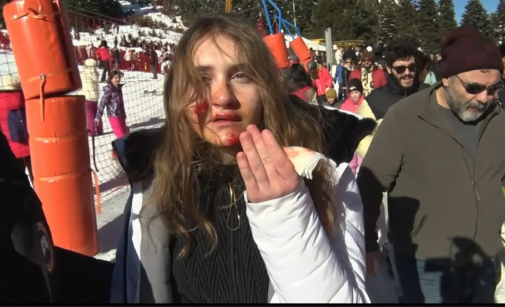 Uludağ'da acemi kayakçılar birbirine girdi: 3 yaralı