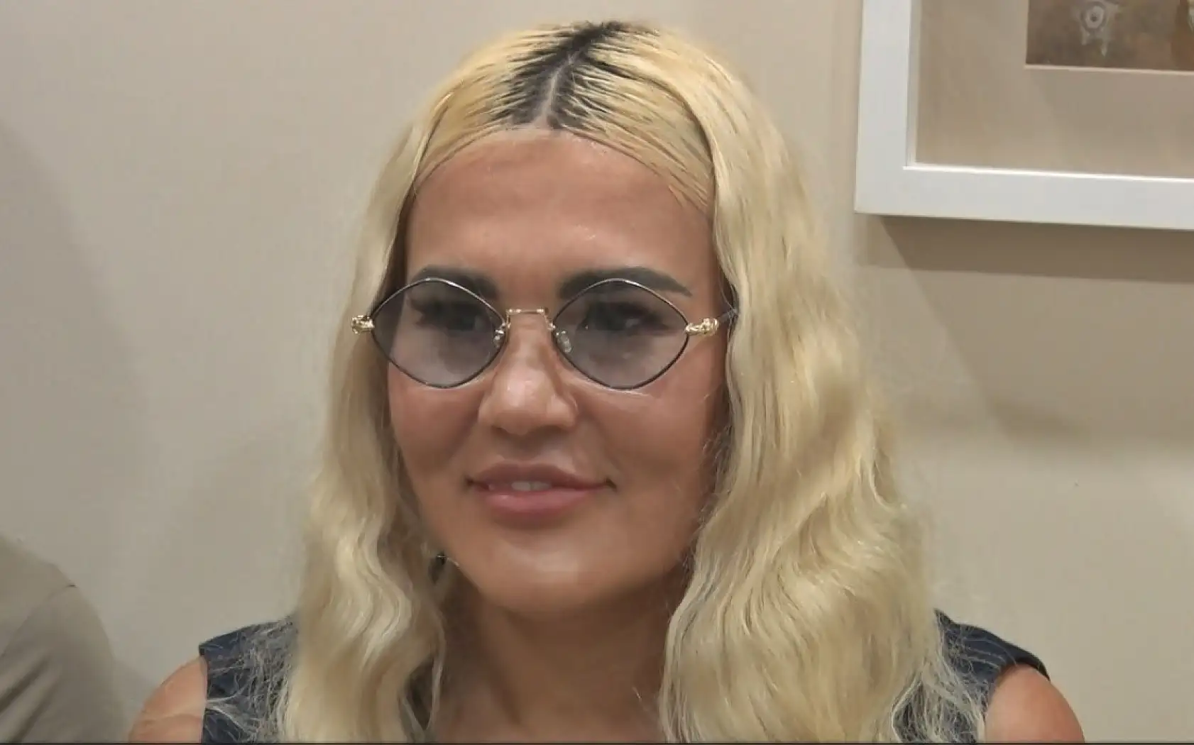Kanseri yenmek için Türkiye'yi seçen Ukraynalı modele '1 cm' delikten gelen şifa