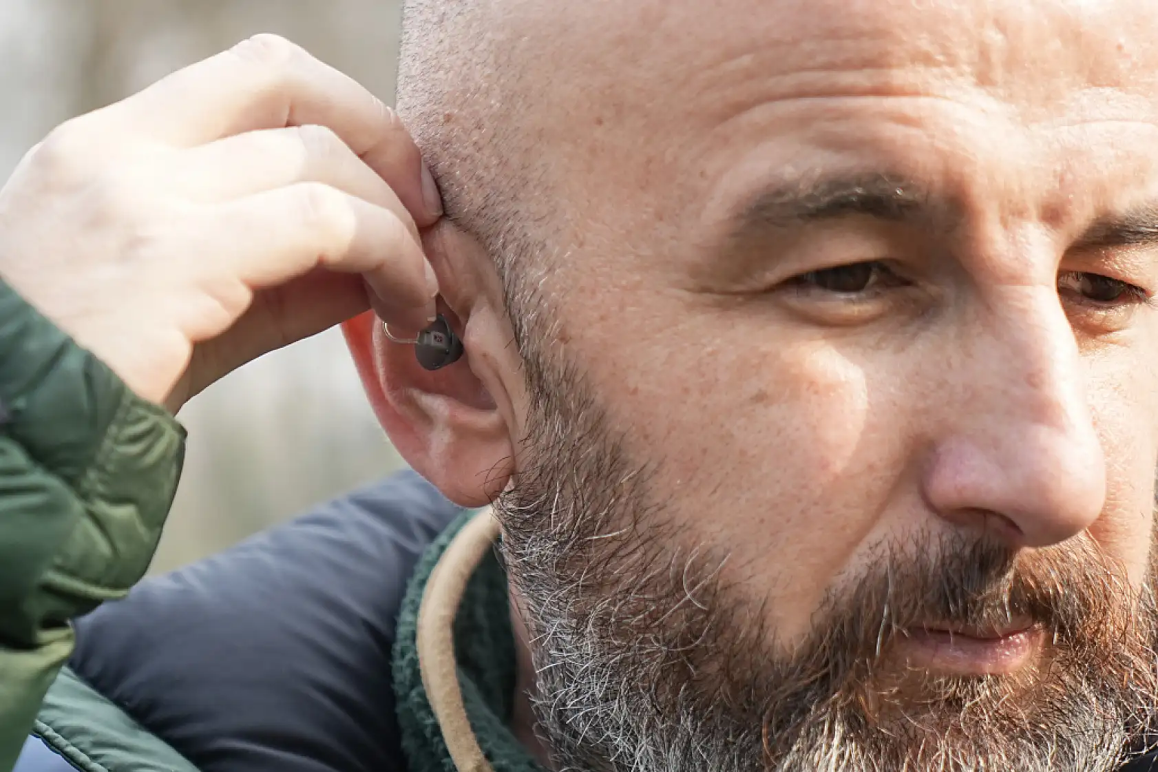 Saç ekerken kulak zarını biçti