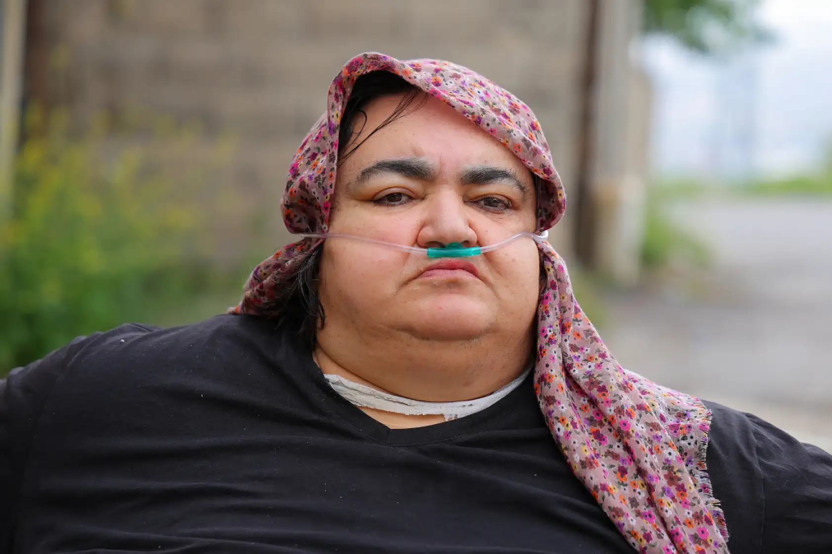 Bir çocuk annesinin zorlu yaşam mücadelesi: Kilosu 200'e dayandı