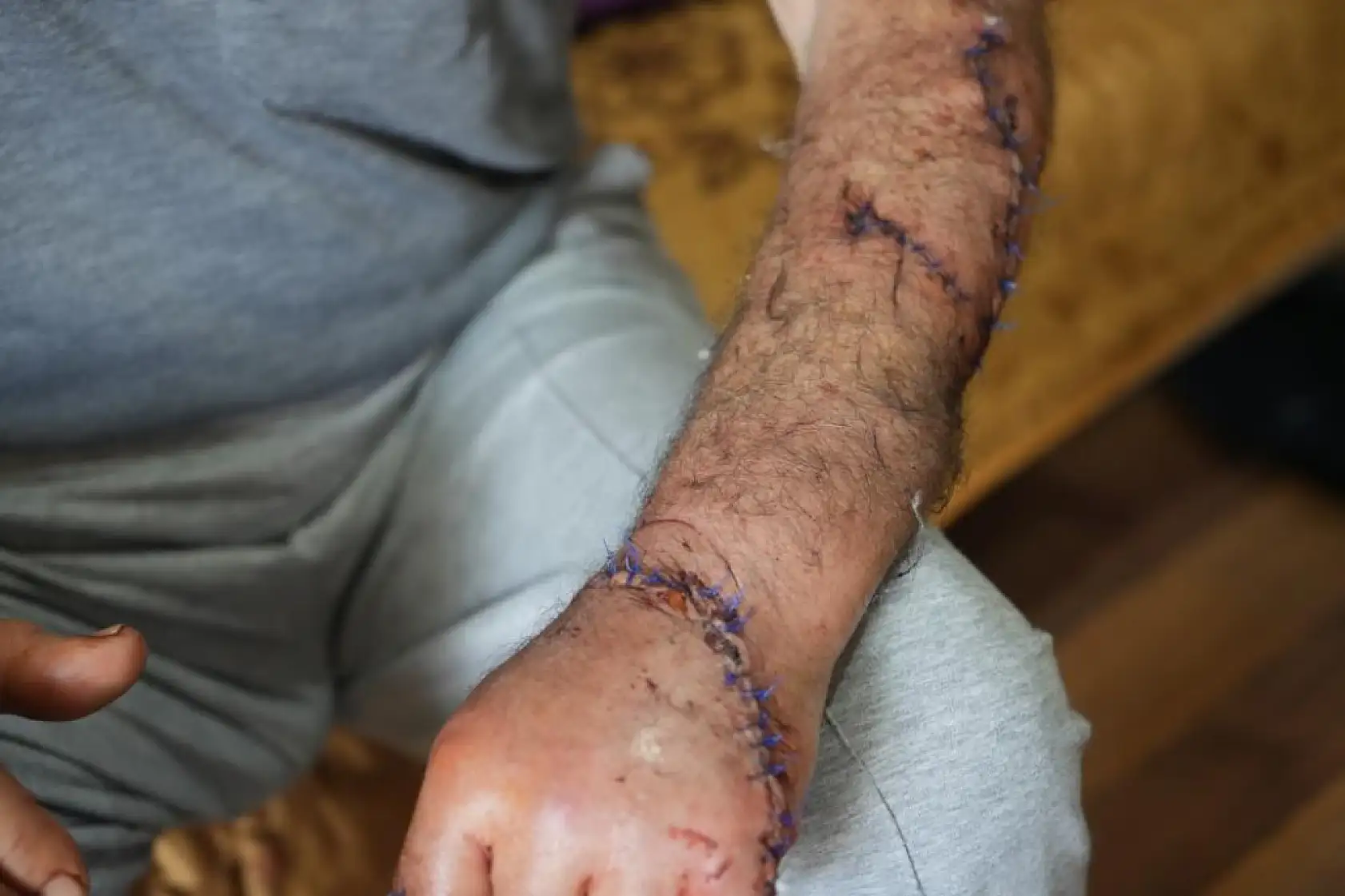 Hakkında uzaklaştırma kararı bulunan adam, barışma çağrısıyla gittiği evde eşi tarafından defalarca bıçaklandı