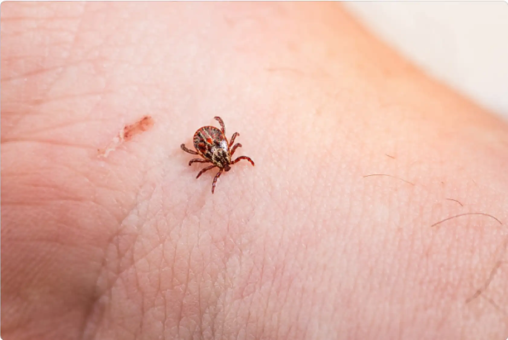 Doç. Dr. Solay: 'Kırım Kongo Kanamalı Ateşi'nin kan ve vücut sıvıları yoluyla bulaştığını biliyoruz'