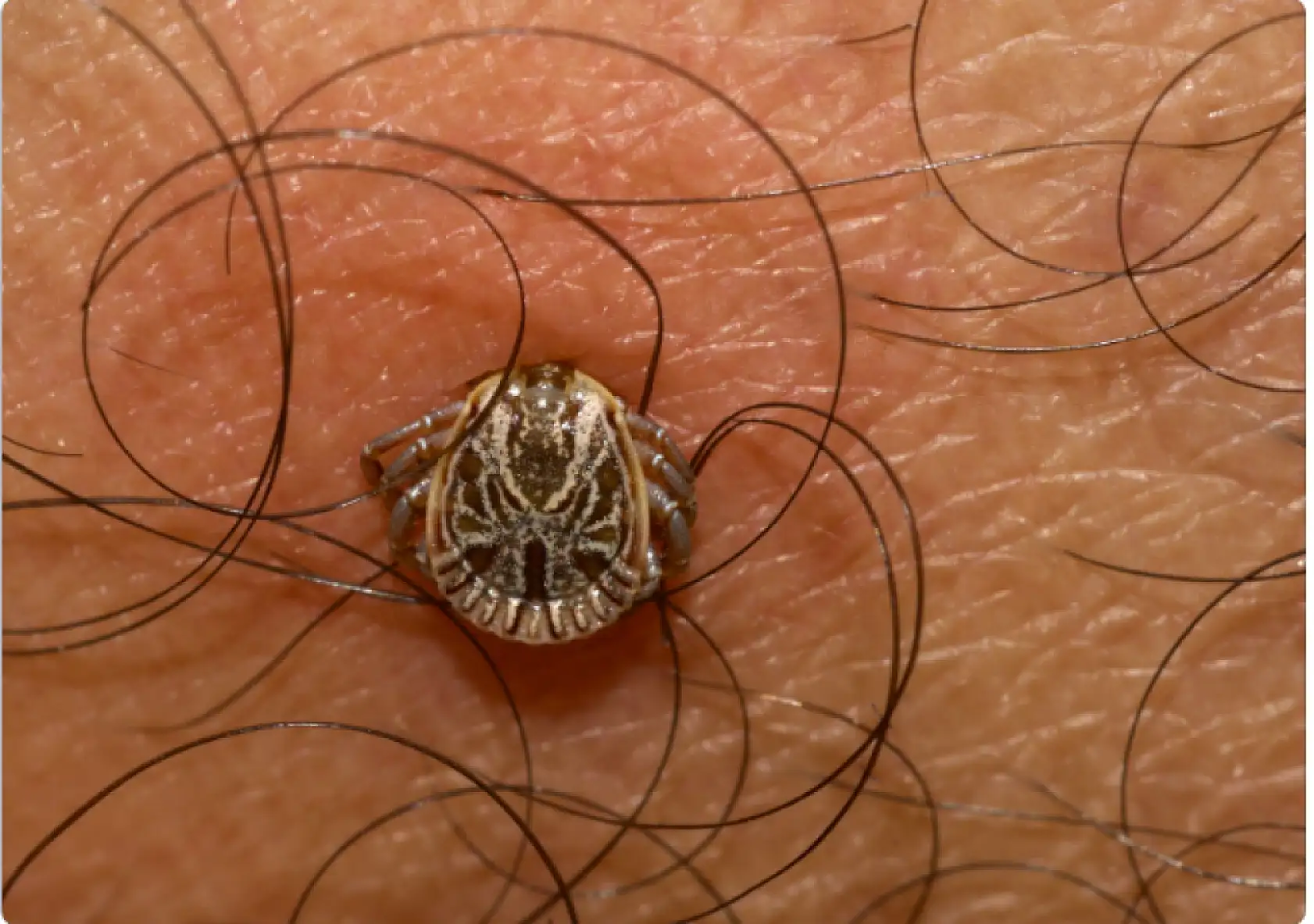 Doç. Dr. Solay: 'Kırım Kongo Kanamalı Ateşi'nin kan ve vücut sıvıları yoluyla bulaştığını biliyoruz'