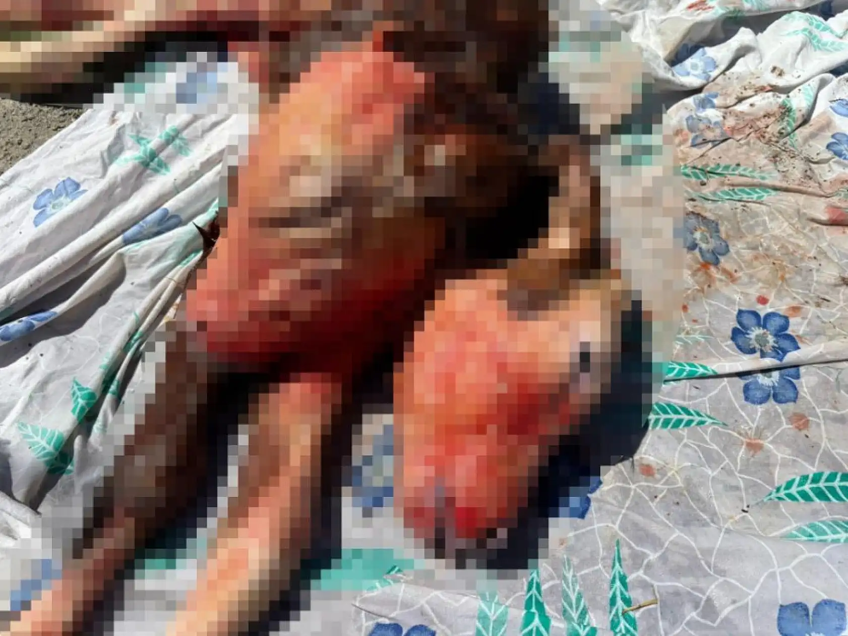 Yüz binde bir görülen olay