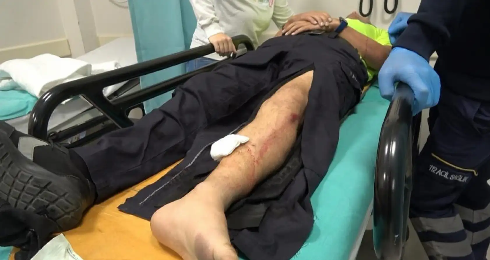 'Dur' ihtarına uymayan 16 yaşındaki çocuk motosikletle polise çarptı