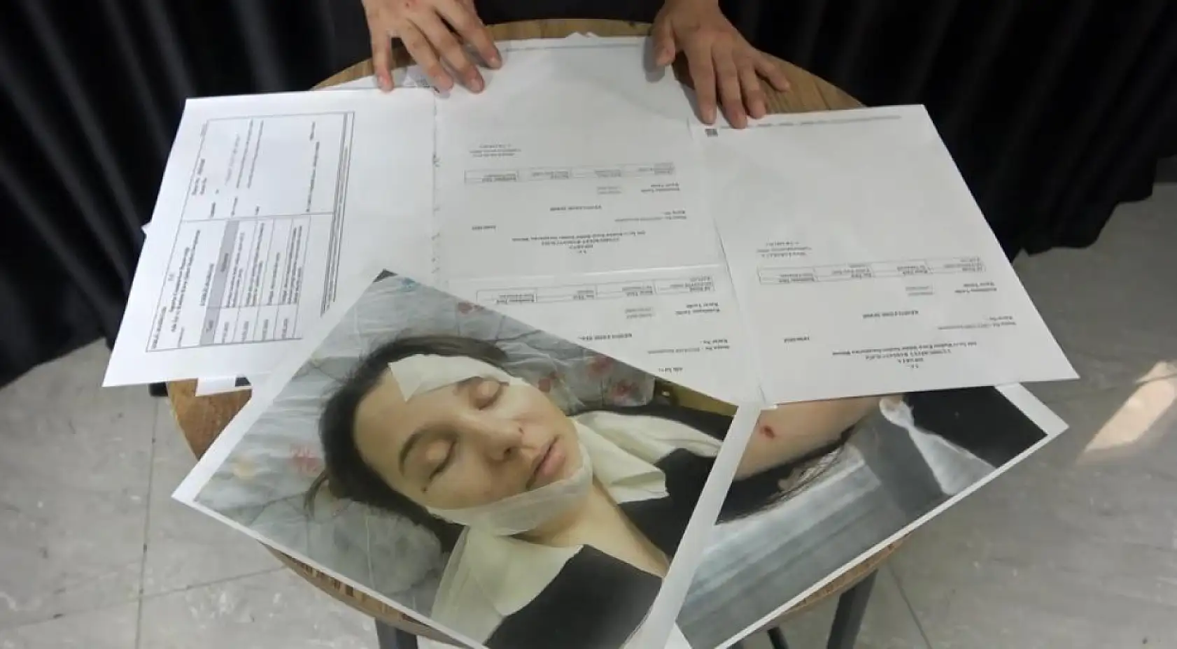 Eski sevgilisi tarafından öldüresiye darp edilen genç kadın yaşadığı kâbusu anlattı