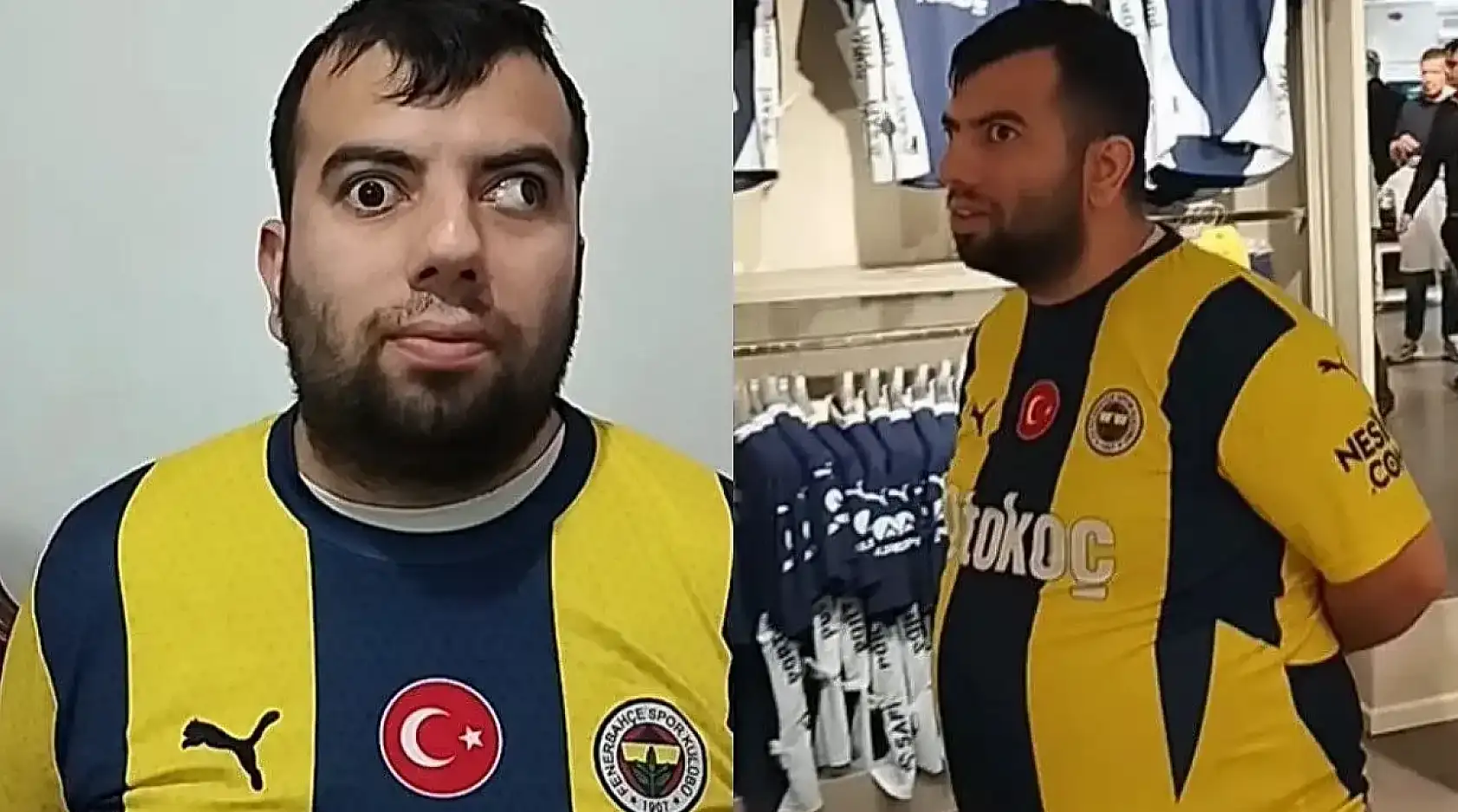 Fenerbahçeli Fenomen 'Kadıköy Boğası' Göz Ameliyatı Oluyor