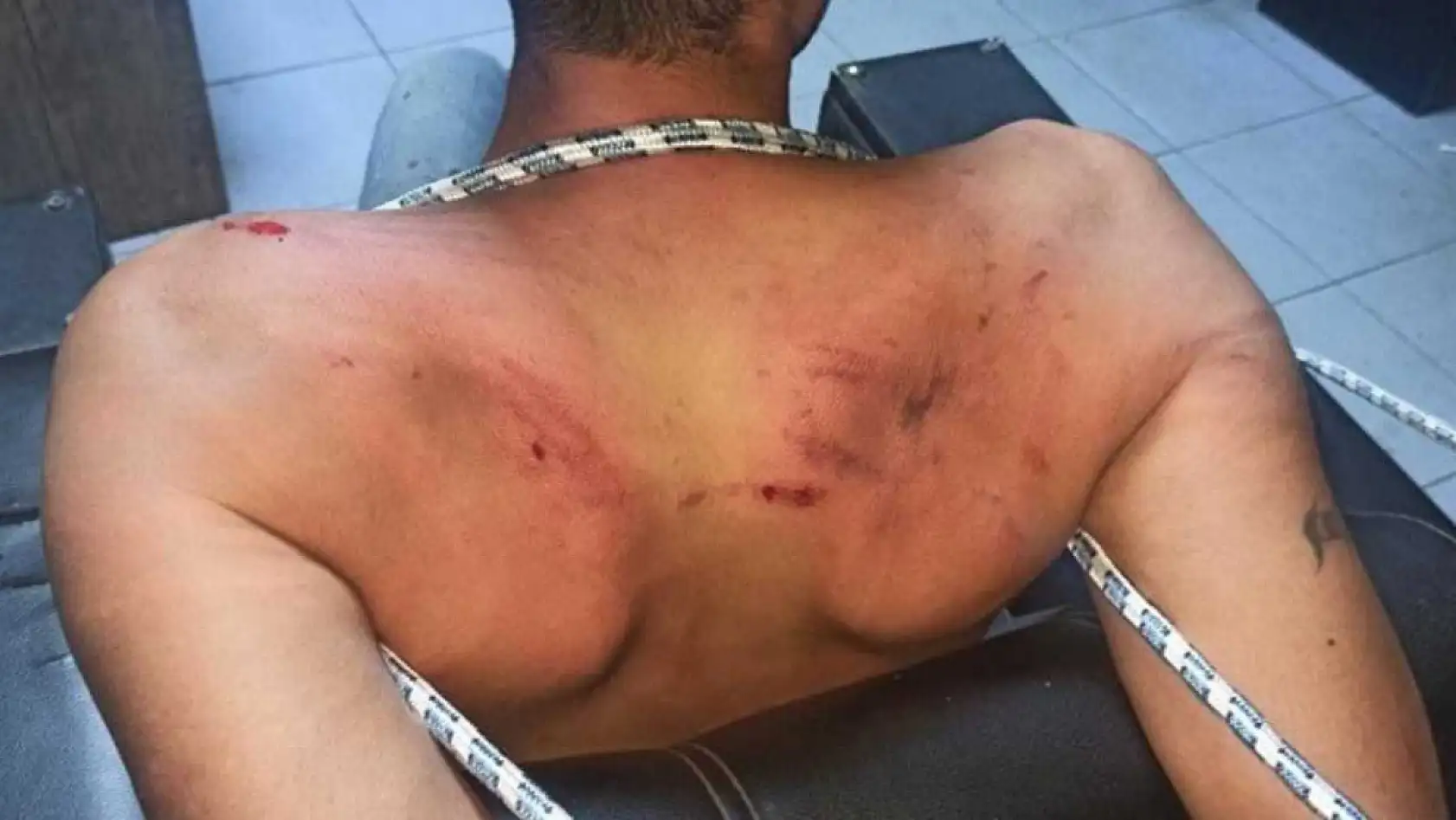 'Böcek yedirip dişlerimi kırdılar' iddiasına 20 yıl hapis talebi