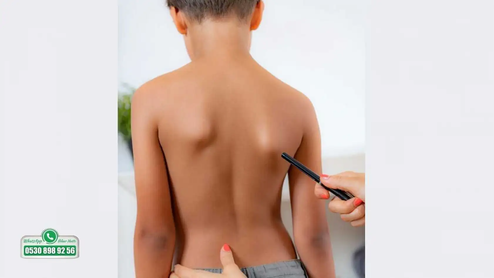 Sinsi ilerleyen bu rahatsızlığı ilk fark eden anneler oluyor