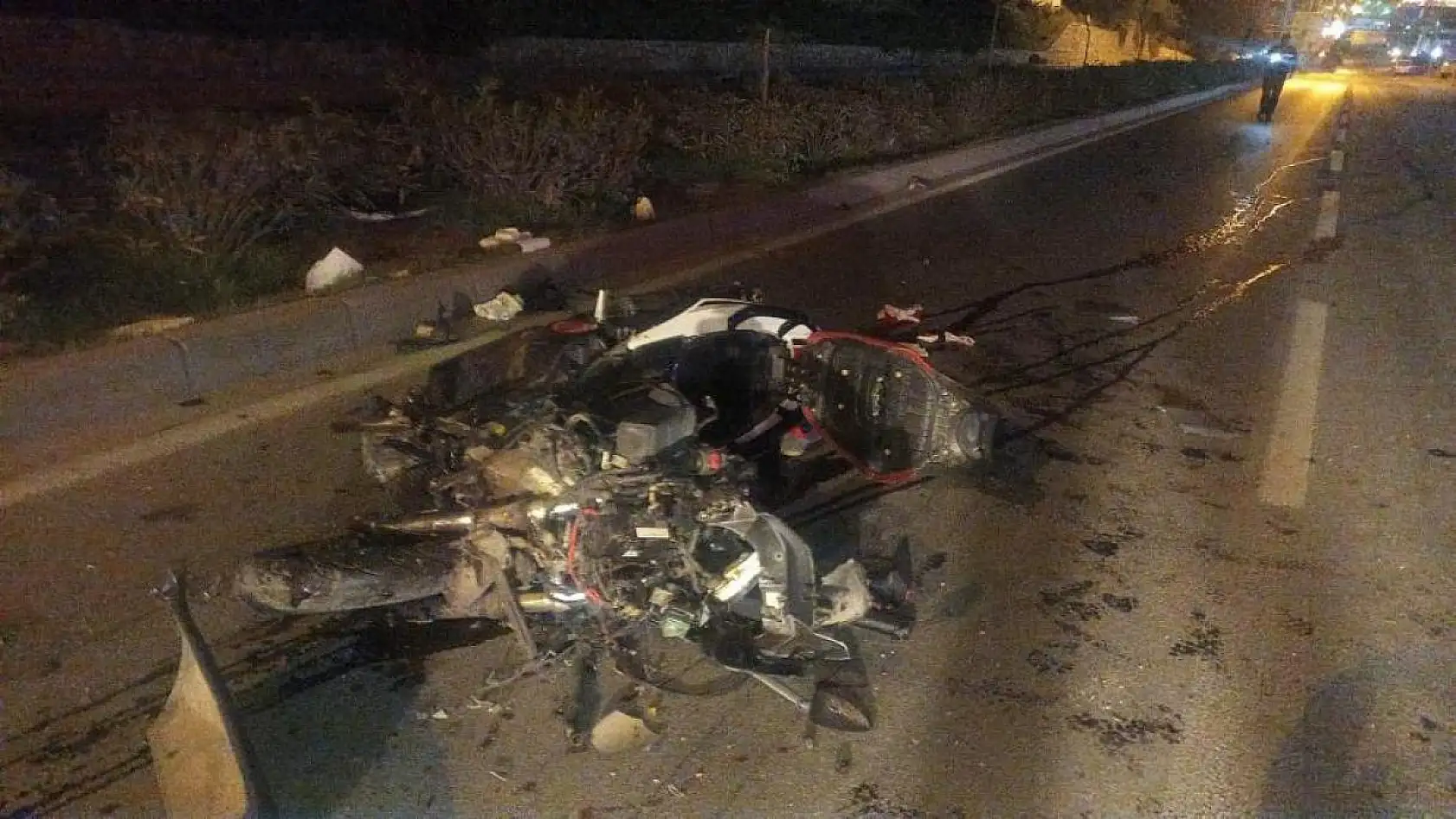 11 aylık yaşam savaşını kaybetti