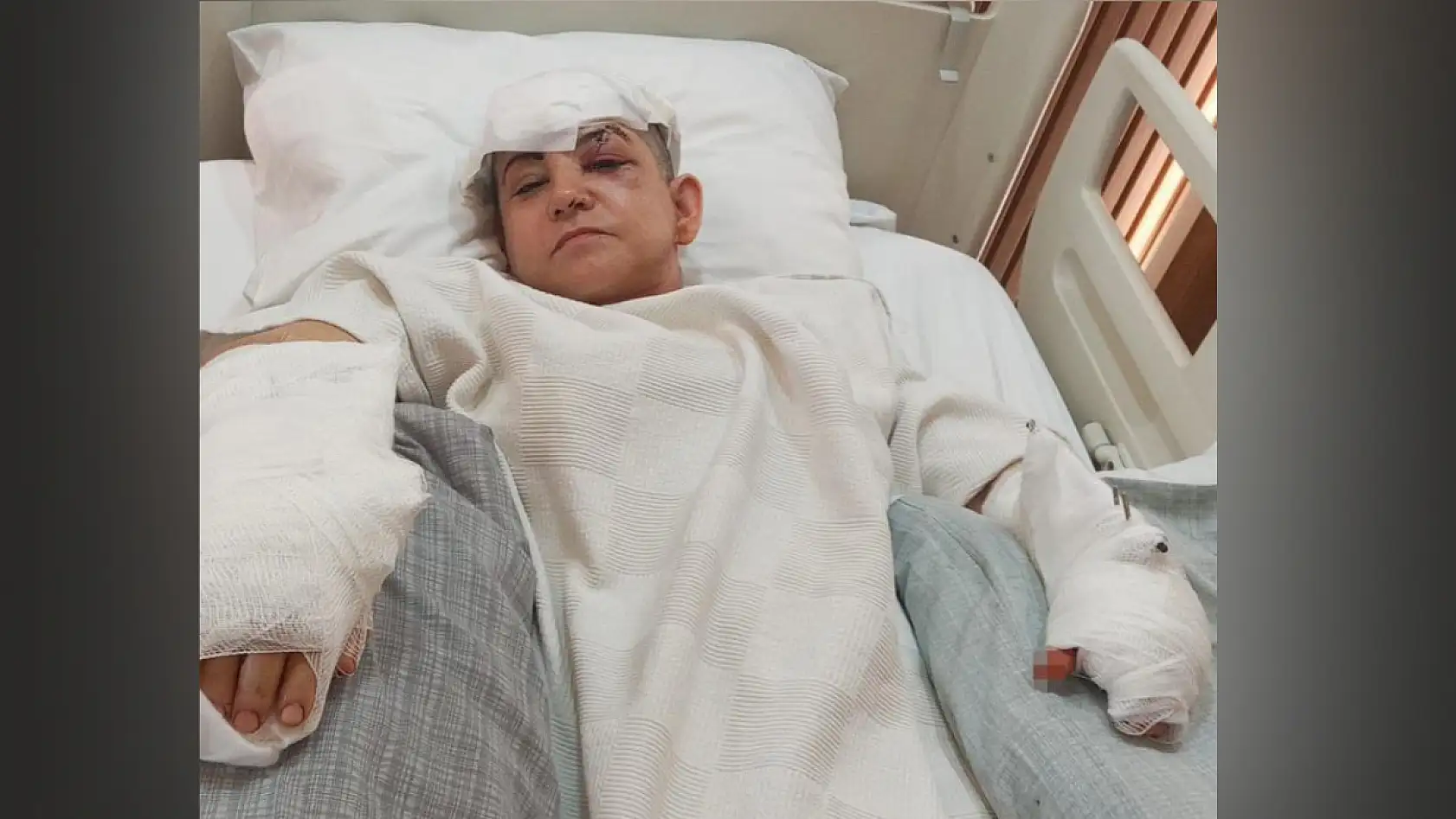 Eşinin satırla ağır yaraladığı kadın yaşadığı dehşeti anlattı