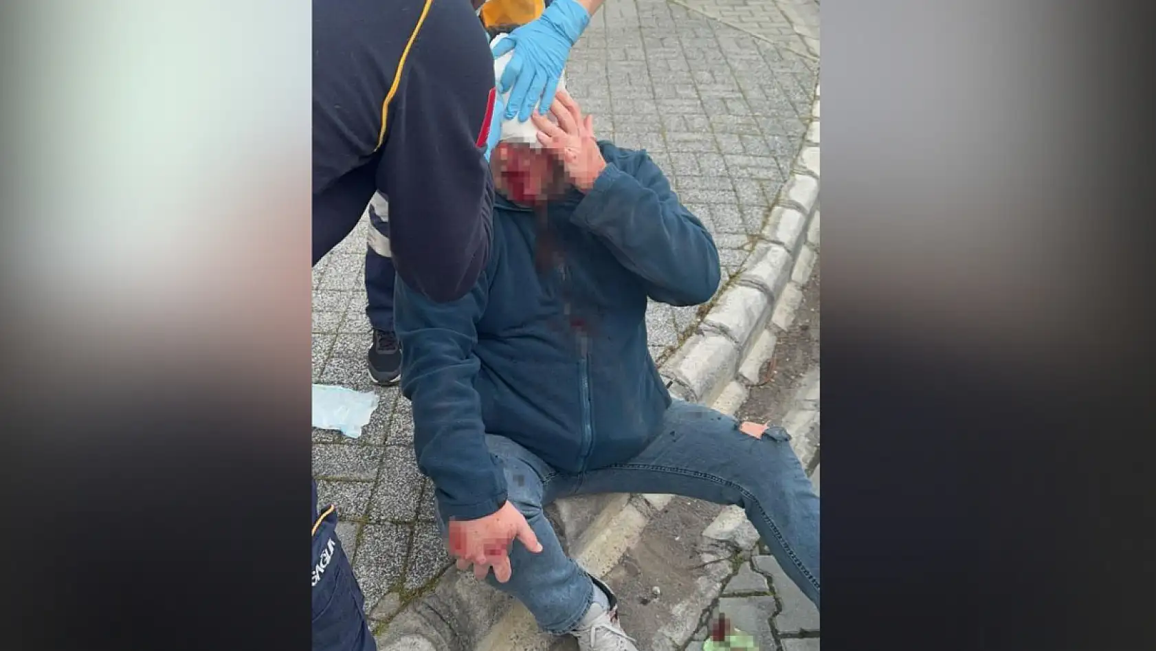 Gazeteci Ersan'a saldırıyla ilgili 5 şüpheli gözaltına alındı