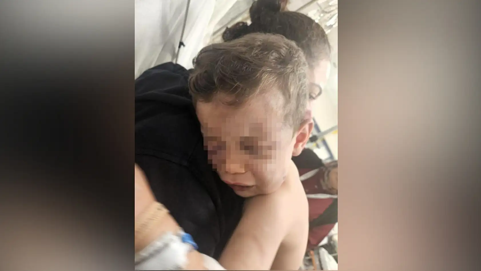 Vahşeti yaşayan 2 yaşındaki bebek hastanelik oldu