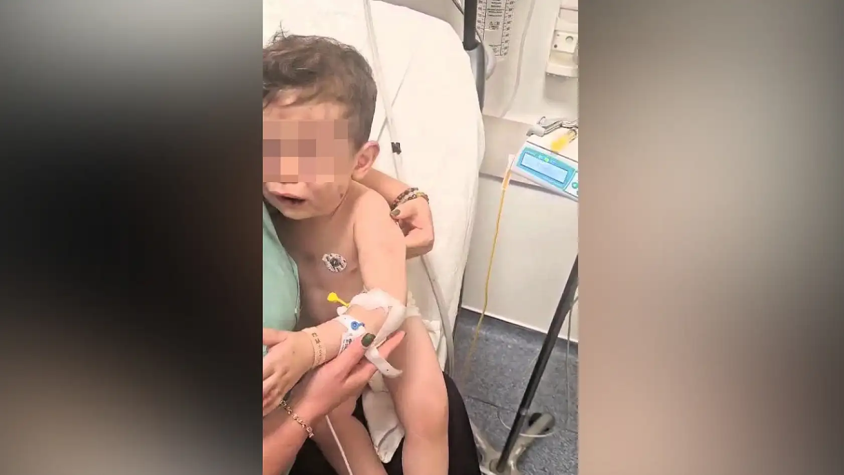 Vahşeti yaşayan 2 yaşındaki bebek hastanelik oldu