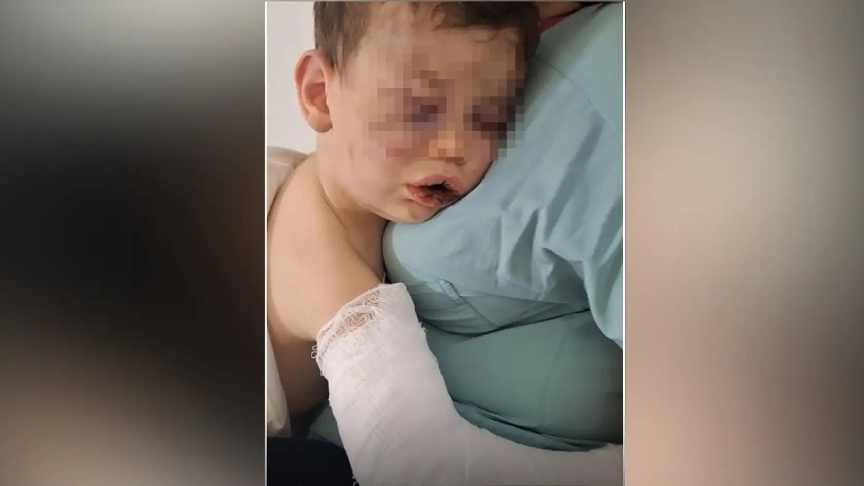 Vahşeti yaşayan 2 yaşındaki bebek hastanelik oldu