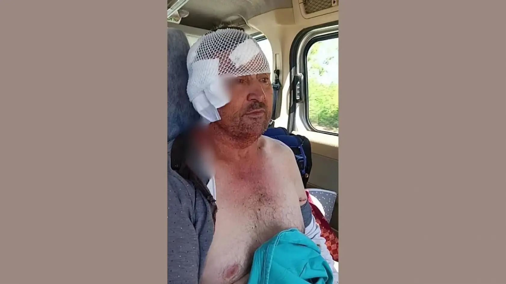 Aslanın saldırısına uğrayan çiftçi o anları anlattı: 'Biraz güçlü olmasaydım, şu anda bende belki de yoktum'