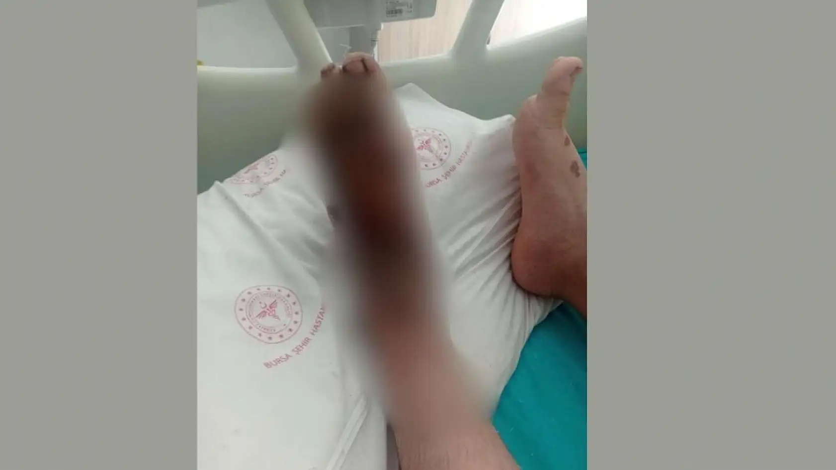 Ailesine maddi destek olmak isterken, ayaklarından oluyordu