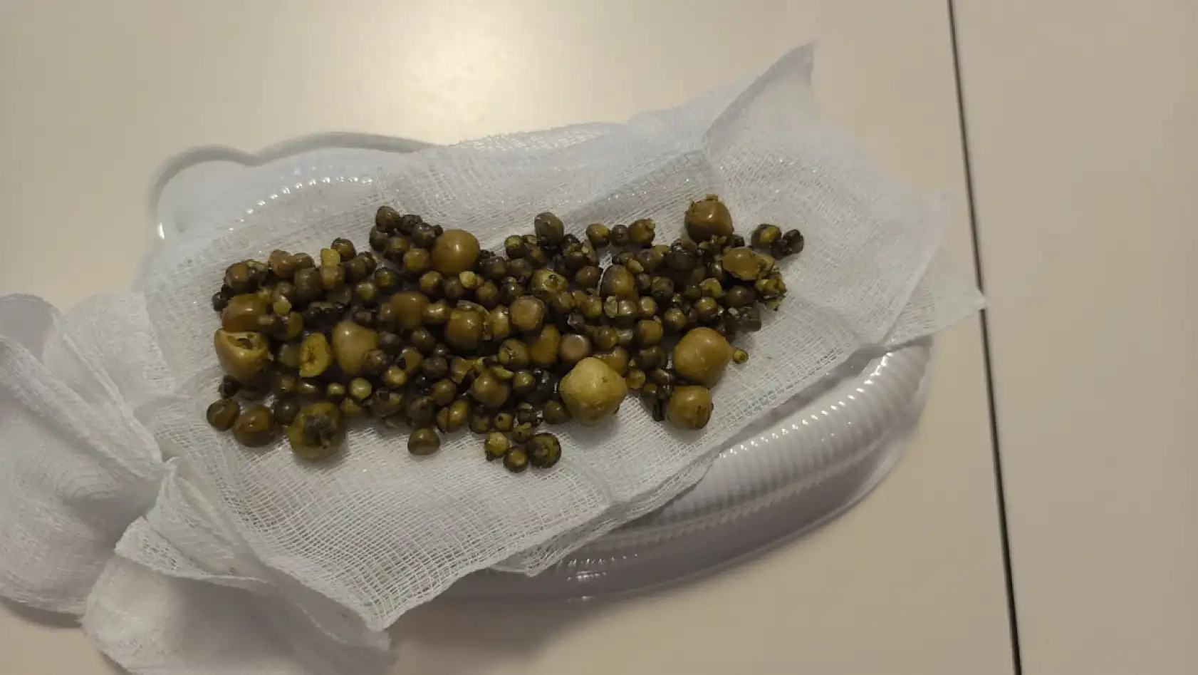 Doktorlar gözlerine inanamadı