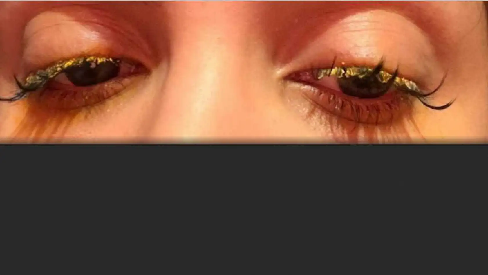 Güzellik merkezinde genç kadının gözüne yapıştırıcı kaçtı: 'Kör olabilirdim'